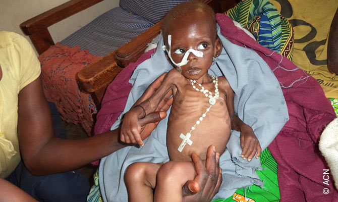 Eine Schwester der Töchter der Auferstehung bei der Betreuung eines unterernährten Kindes in Bukavu-Mirhi.